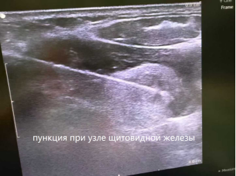 fuda15_676344.png image.png